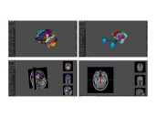 AnaVu: IIIT-Hyderabad’s 3D Anatomy Visualization Platform