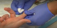 Louisiana ranks among highest in nation for STI rates