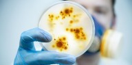 Qué son las “bacterias pesadilla”: los casos aumentan en EEUU y encienden alarmas sanitarias