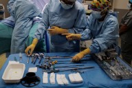 Médicos hallan un cuchillo enterrado durante ocho años en el tórax de un paciente