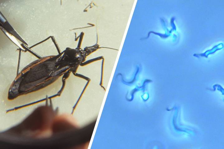 What is Chagas Disease? The Scary Truth About the ‘Kissing Bug’ Parasite Spreading in the US (Video)