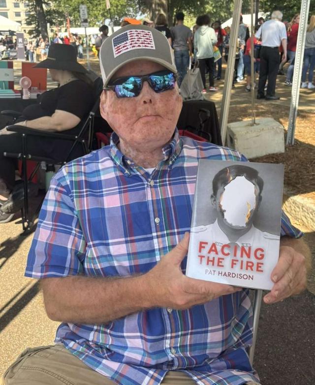 Pat Hardison, Mississippi’s first face transplant survivor, tells a story of fear, faith and a second chance