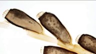 Body lice were found at the University of Maryland