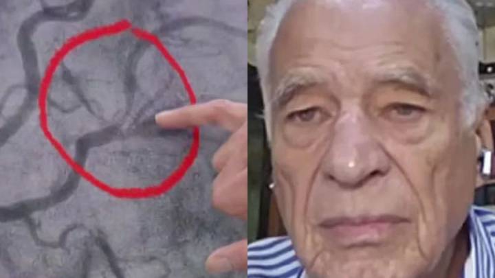Alberto Cormillot relató el susto que vivió por un dolor en el pecho: qué le pasó