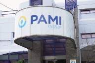 Denuncian que el PAMI compró lentes intraoculares por un valor cinco veces mayor al de mercado