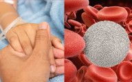 Incrementan casos de linfoma en Tamaulipas