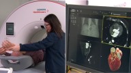 Revolutionary heart imaging technology arrives in western Sydney