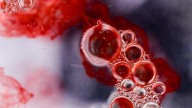¿Tiene controlado el colesterol? Así se pueden reducir los riesgos graves, que pocos hacen