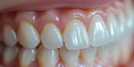 Cuál es la deliciosa fruta que ayuda a controlar la glucosa, protege al corazón y previene las caries