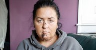 Coatbridge mum and daughter left with facial injuries after bully dog attack