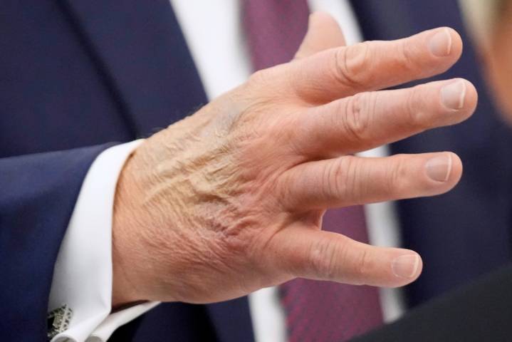 President Trump addresses health rumors after days without public events