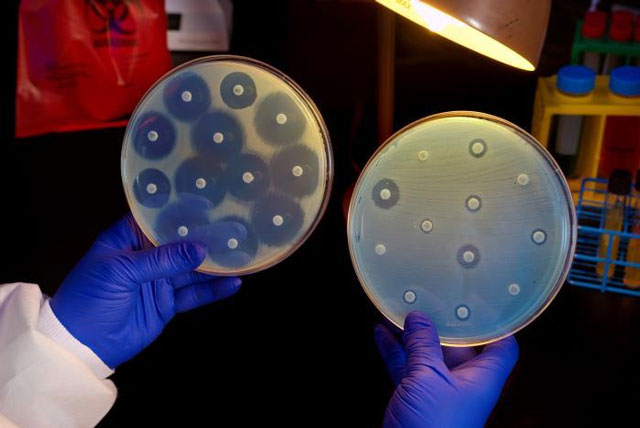 US sees 69% rise in hard-to-treat superbug infections, CDC warns