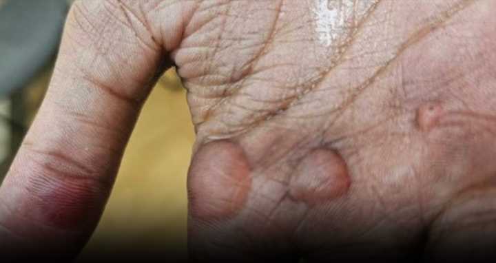 Student suffered second-degree burns at majorette practice at Warren Central High School