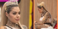 Melissa Gate revela el motivo por el que se retiró las prótesis de glúteos tras un accidente en su casa: “Era un dolor muy fuerte”