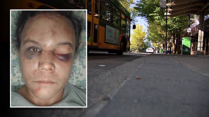 3rd teen arrested in Renton hate crime assault