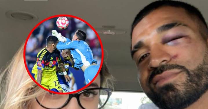 Así le quedó el rostro a Rodrigo Aguirre tras el fuerte golpe ante San Luis; ¡como boxeador! (FOTO)