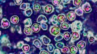 Measles case confirmed in Fulton County, exposures possible