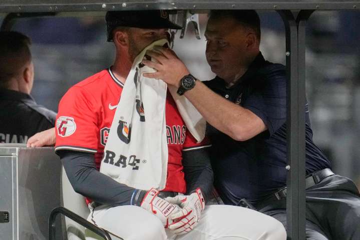 Guardians’ David Fry taken to Cleveland Clinic for further tests after taking pitch to the face