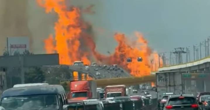 Quemaduras por accidentes: dónde recibir atención médica tras la explosión de pipa en Iztapalapa