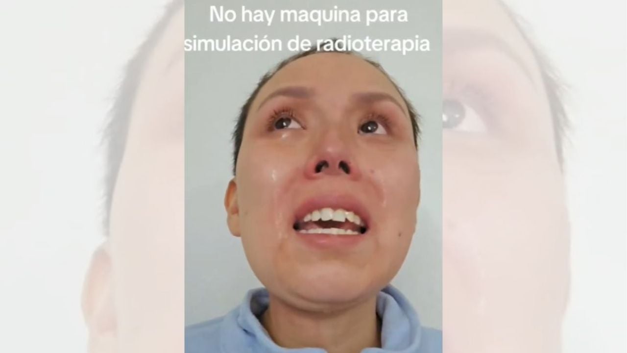 ISSSTE restablece procedimiento de simulación para iniciar radioterapia a derechohabiente
