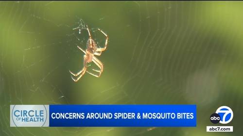 Spider bite or mosquito bite? How to tell the difference