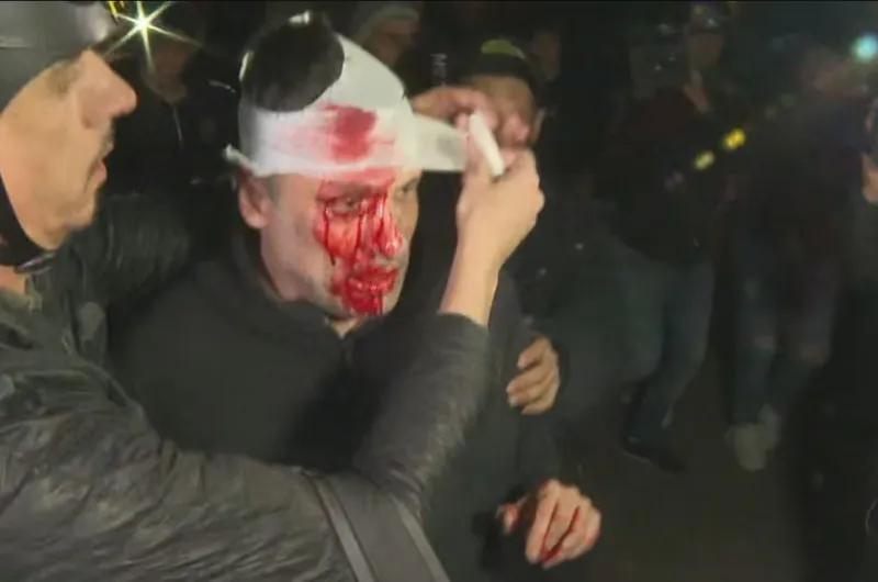 Incidentes en Moreno: un periodista recibió un botellazo antes del acto de Milei