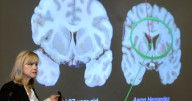 Here's what to know about CTE, the brain disease the NYC shooter blamed for his mental health issues