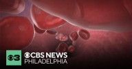 With more Black people donating blood, the Red Cross says it's helping with sickle cell disease