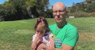 Bay Area man raises alopecia awareness, reflects on its challenges