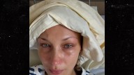 Bella Hadid Posts Cryptic Health Update After Going 'MIA'