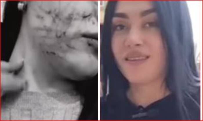 Así quedó el rostro de comerciante tras ataque en Bogotá
