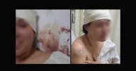 Alumna de secundaria ataca a hachazos y cuchilladas a madre de familia en Delicias
