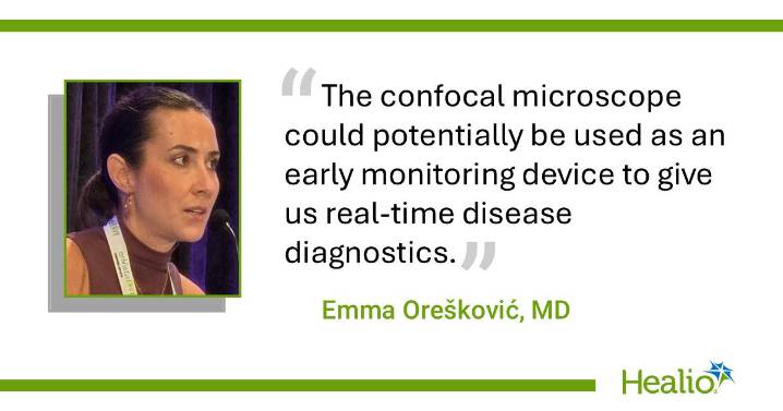 Confocal microscopy identifies corneal nerve fiber irregularities