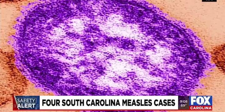Safety Alert: Four Measles cases in South Carolina