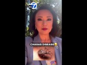 Chagas disease from 'kissing bugs' found in SoCal