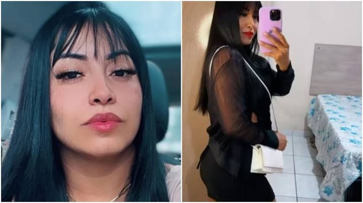 Una mujer murió de una “enfermedad repentina” tras hacerse un relleno de glúteos con hidrogel en Brasil
