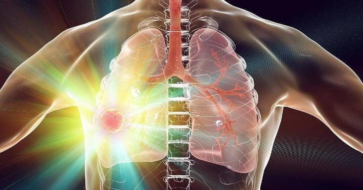 Robot-Guided Device Reaches Tumors Deep In The Lungs