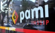PAMI negó sobreprecios en la compra de lentes intraoculares