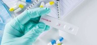 Reportan 9 casos de COVID-19 y 18 de influenza