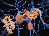 Fiber-Optic Method Allows Longitudinal Study of Alzheimer’s Pathology