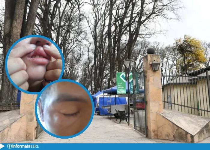 Agredieron a inspectoras de la Municipalidad en el Parque San Martín