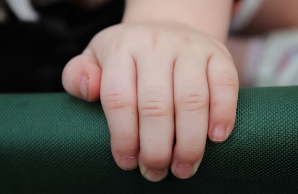 Se desata enfermedad de manos, pies y boca en guarderías y escuelas de esta zona de Estados Unidos: emiten alerta sanitaria