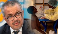 OMS: Mpox deja de ser una emergencia mundial de salud