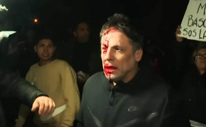 Un periodista fue agredido a la salida del acto de Milei en la localidad bonaerense de Moreno