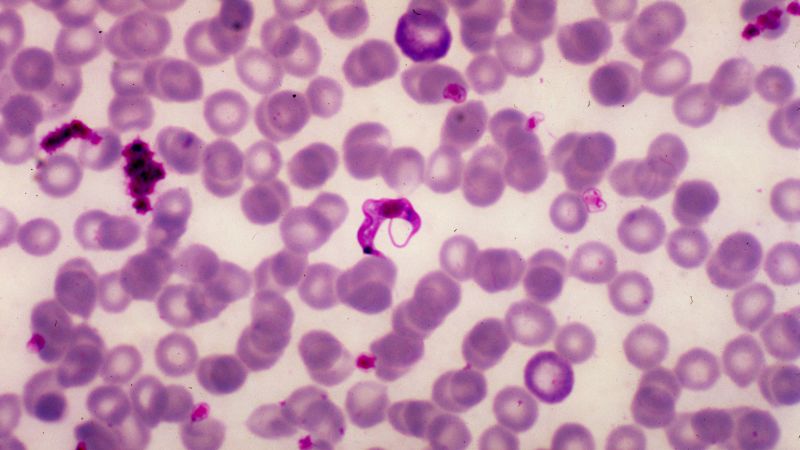 What are your questions about Chagas disease, aka ‘kissing bug’ disease?