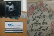Inside look at Catholic fertility care