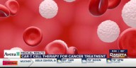 CAR-T cell therapy for cancer treatment