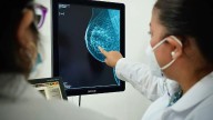 Durante 2024 alrededor de 150 mujeres morelianas fueron detectadas con cáncer de mama