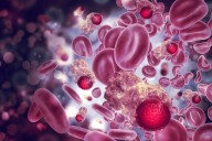 Avances médicos duplican sobrevida en mieloma múltiple
