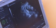 WATCH LIVE: WIS sits down with current, former state lawmakers ahead of abortion bill hearing